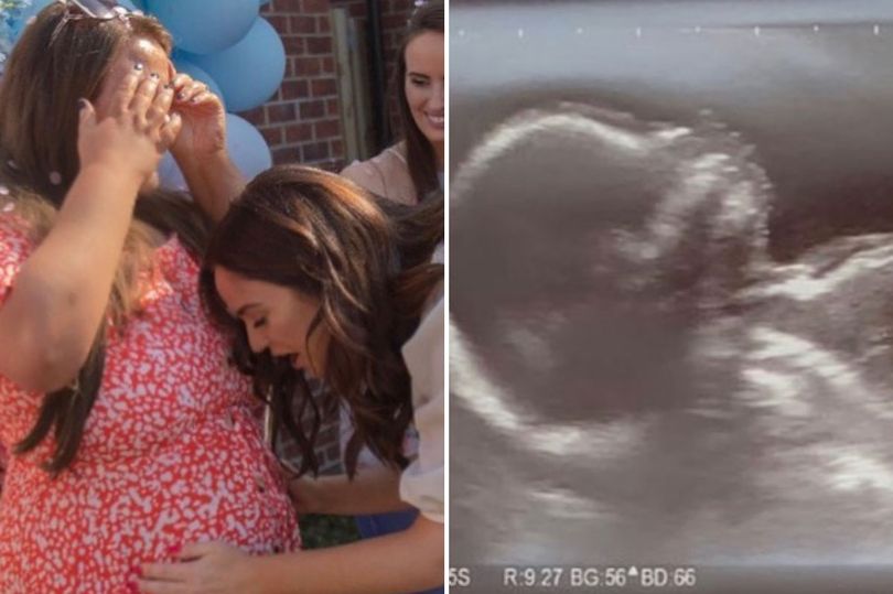 Vicky Pattison sparks pregnancy rumours as she posts ultrasound of unborn baby