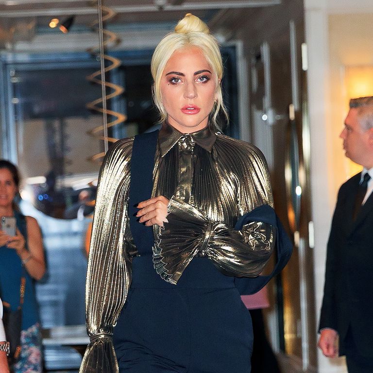 Lady Gaga Just Shared An Arm X-Ray Photo Following Her Stage Fall On Instagram