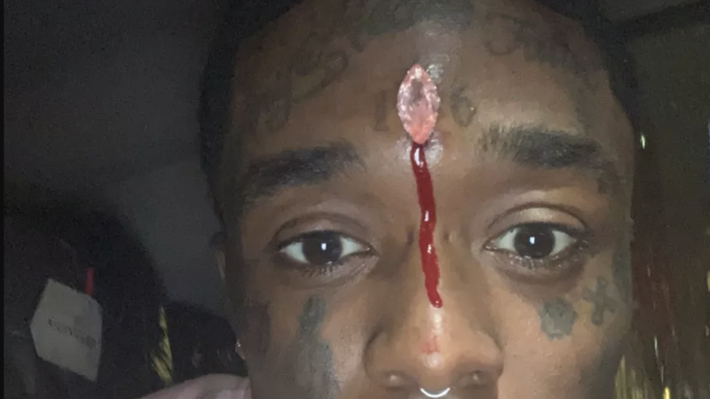 Lil Uzi Vert Pierced His Forehead With a $24 Million Pink Diamond