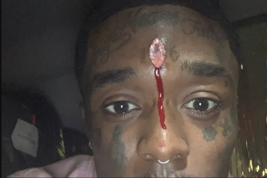 Lil Uzi Vert Pierced His Forehead With a $24 Million Pink Diamond