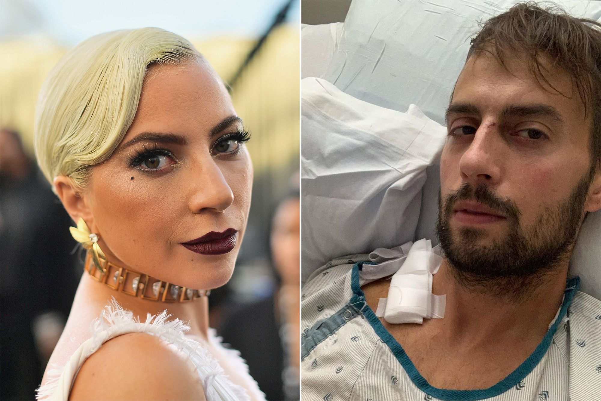 Lady Gaga’s dog walker Ryan Fischer feels ‘abandoned,’ begs for donations