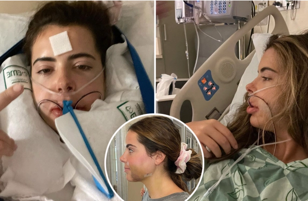 Brielle Biermann shares shocking recovery photos of her double jaw surgery after ‘sucking her thumb until she was 9’