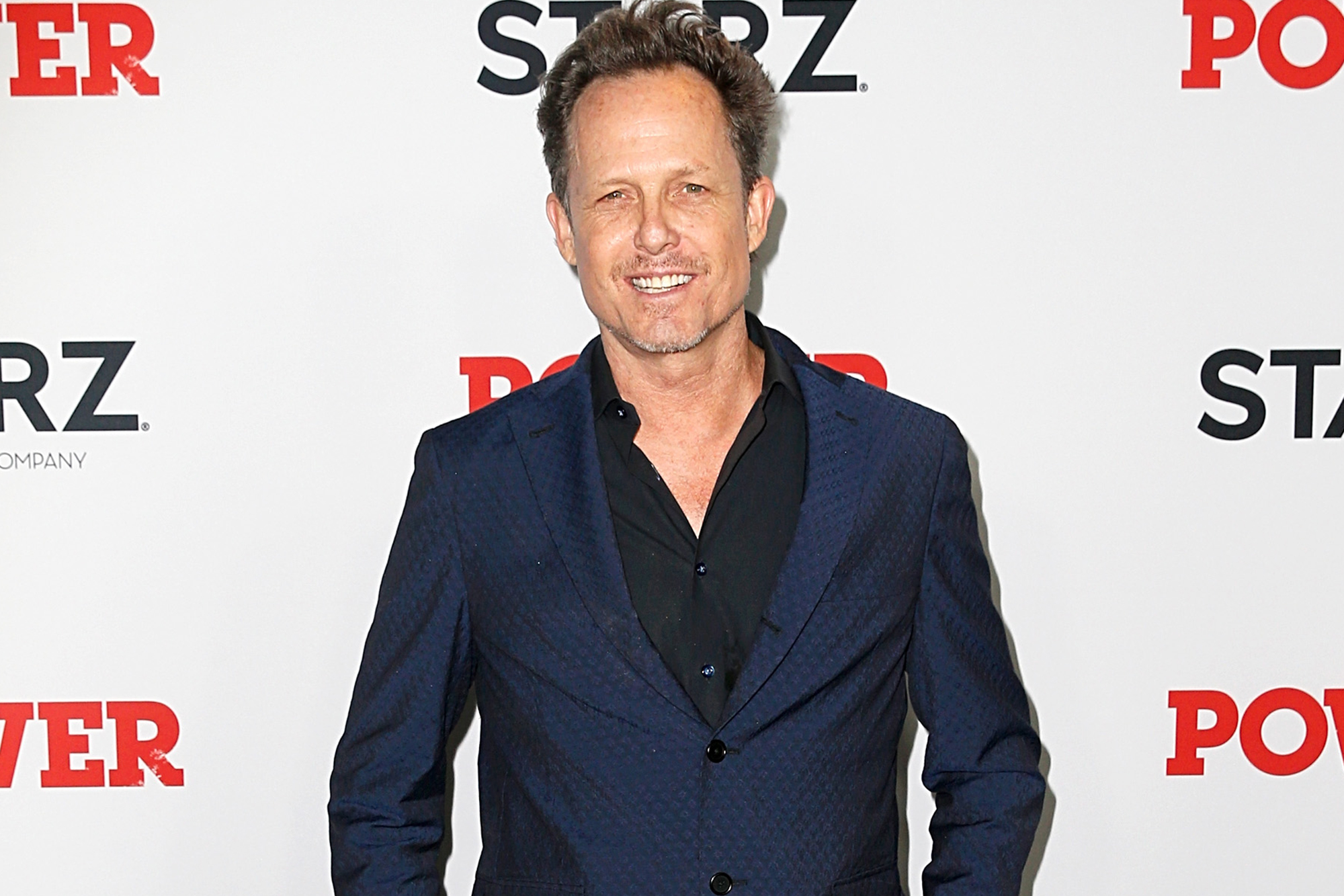 Dean Winters is in constant pain from multiple amputations